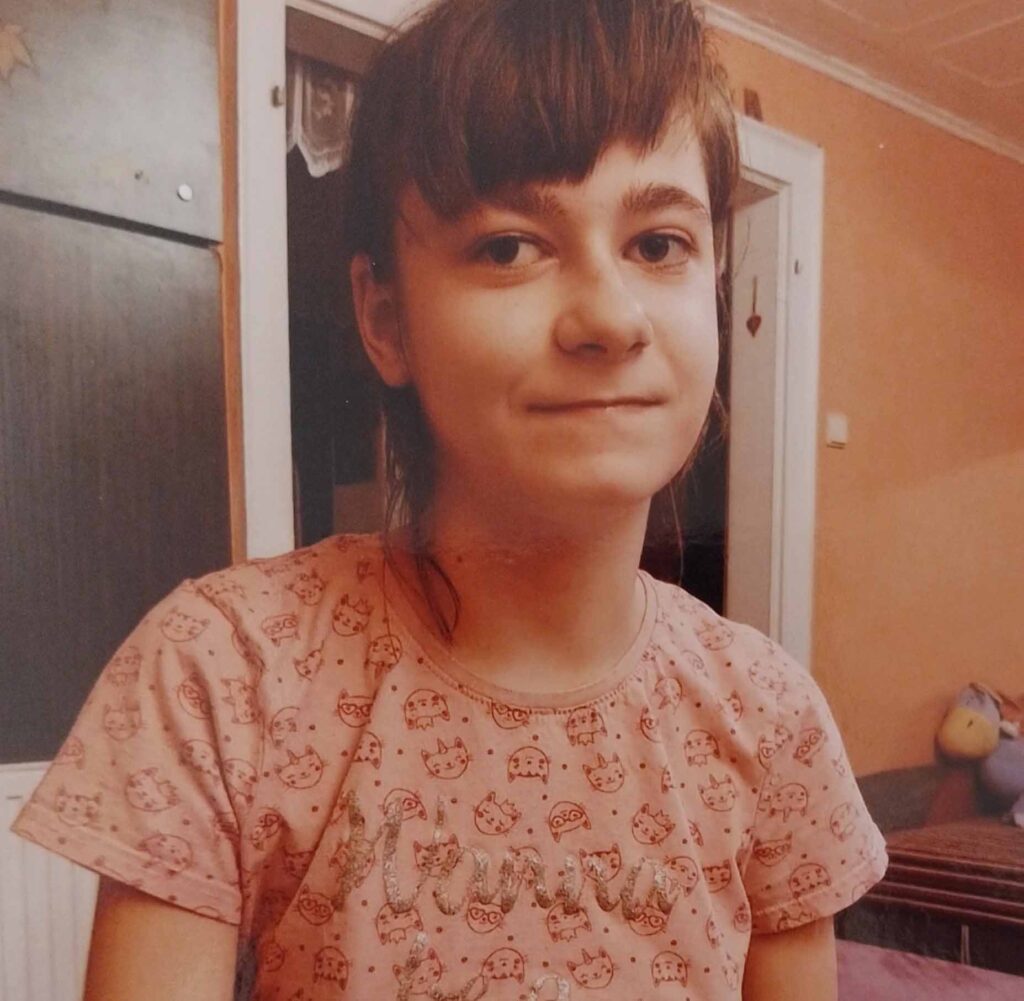 Magdalénka - 17 let, PhelanMC Dermidůvsyndrom, Šumická bota